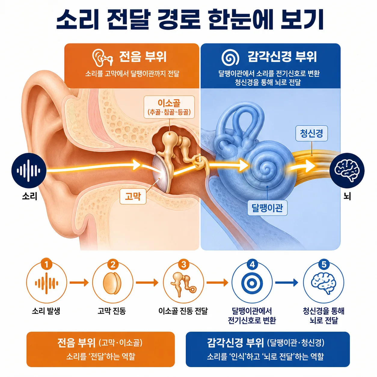 소리 전달 경로와 이명·난청이 함께 생기는 지점을 표시한 귀 단면 인포그래픽