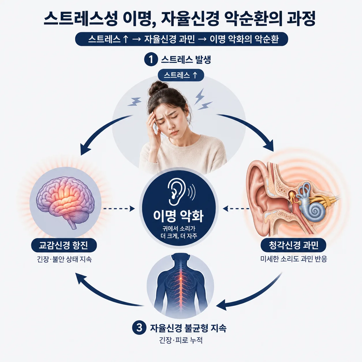 스트레스성 이명이 자율신경 과민으로 이어지는 과정을 설명하는 이미지