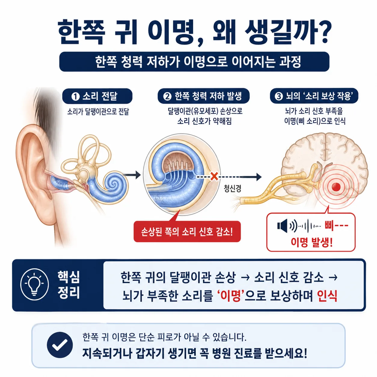 한쪽 귀 이명의 원인을 설명하는 청각신경 구조 이미지
