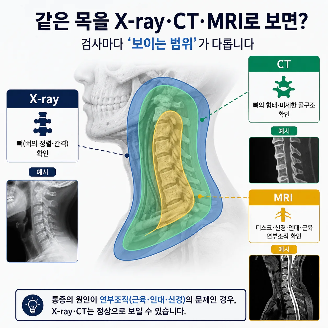 교통사고 검사 정상일 때 X-ray CT MRI가 보는 범위 비교