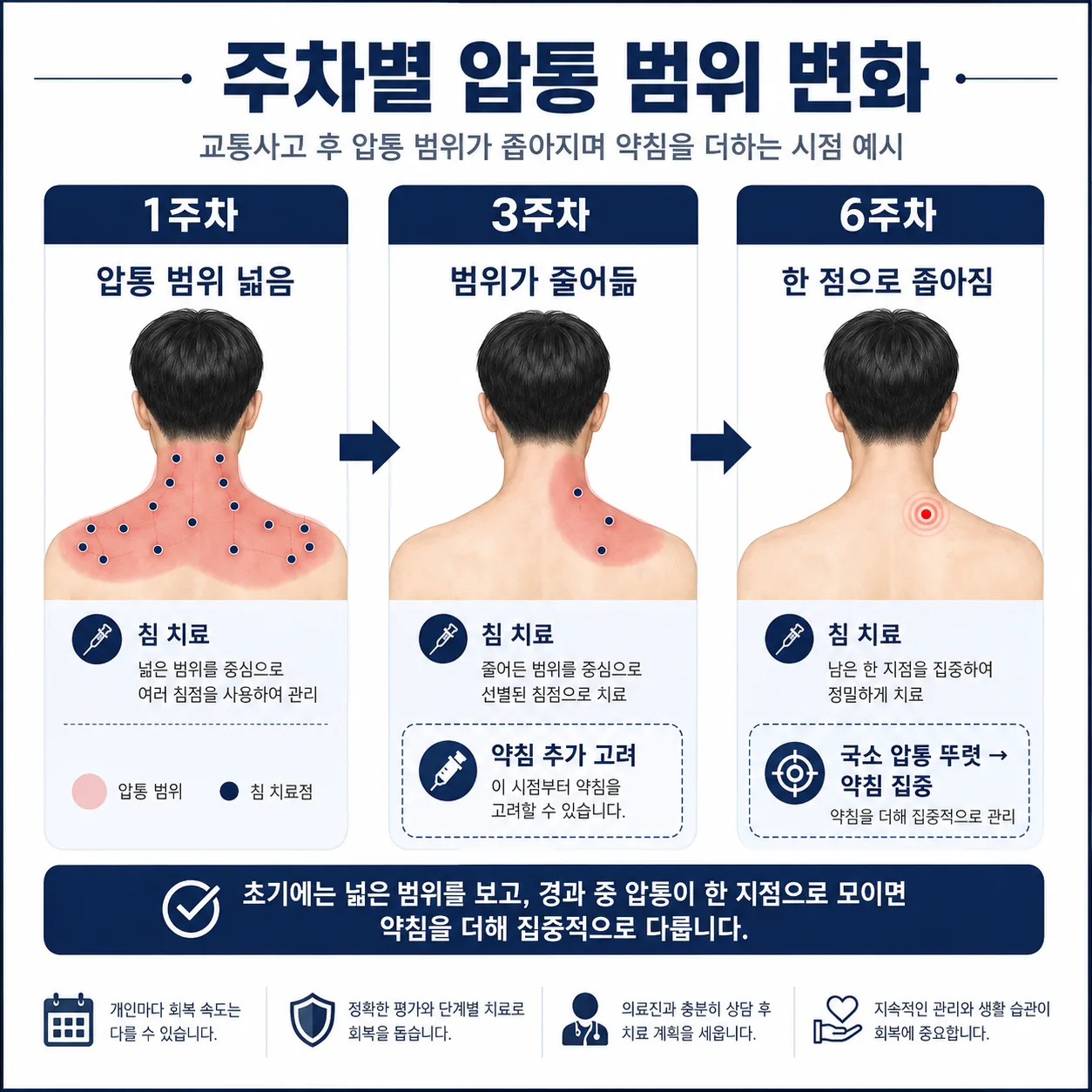 교통사고 후 주차별로 압통 범위가 좁아지면서 약침을 더하는 시점을 보여주는 도표